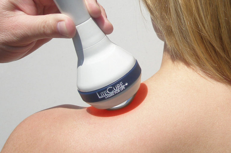 LiteCure Laser Treatment