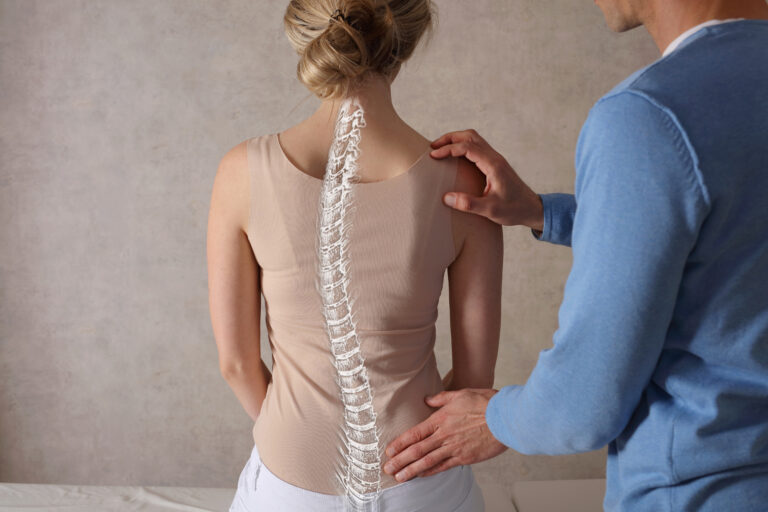 scoliosis spine overlay